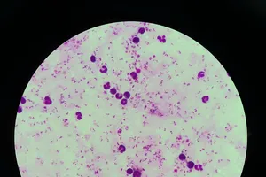 TP.HCM: Hai người trở về từ Châu Phi mang theo virus sốt rét ác tính