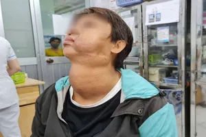 Cắt bỏ khối bướu đẩy lệch thanh quản và thực quản người phụ nữ 