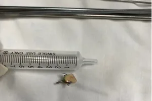 Súc miệng làm rơi răng giả, cô gái phải nhập viện cấp cứu