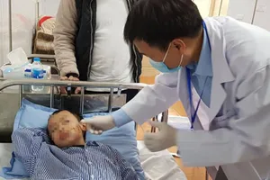 Hà Nội: Bé trai 8 tuổi bị chó béc giê cắn rách mặt và môi