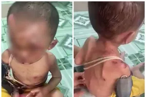 Công an làm rõ vụ bé trai nghi bị bạo hành 