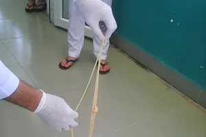 Lấy con sán xơ mít dài 8 m ra khỏi cơ thể bệnh nhân