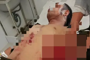 Nổ mìn tự chế, 3 cháu bé và 4 người bị thương