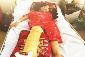 Nghi ô tô tông gãy chân, tay học sinh rồi bỏ trốn