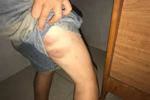 Công an vào cuộc vụ bé trai bị cha, bà nội đánh đập