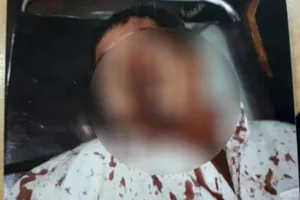 Bị vây đánh giữa đường nghi vì khoản nợ của vợ