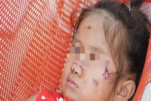 Chó hoang tấn công bé gái 2 tuổi tại Tây Ninh