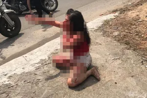 Phẫn nộ: Cô gái bị người tình cũ rạch mặt tàn ác