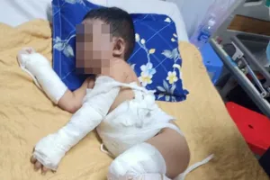 Bình Dương: 1 gia đình bị ném bom xăng, 2 bé trai bỏng nặng