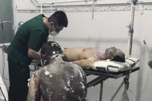 Bình Dương: Nhiều công nhân bị bỏng khi lửa bùng lên trong công ty