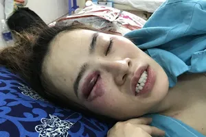 1 thanh niên đánh cô gái trong quán bánh xèo nhập viện