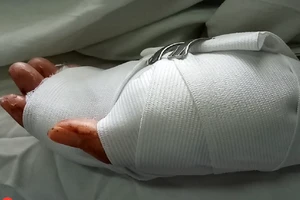 Cô gái bị nhóm thanh niên truy sát trong quán game bắn cá