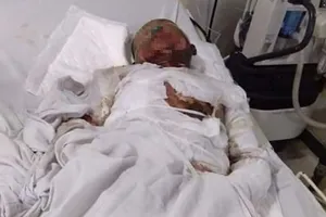 Cứu vợ tự tử, 3 người bị bỏng nặng