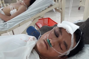 Bị đồng nghiệp đánh bất tỉnh vì giành máy dệt trong xưởng