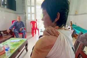 Vợ mang bầu 7 tháng bị chồng ở Hải Dương bạo hành