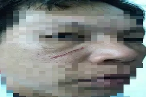 Xưng phóng viên, đánh công an xã