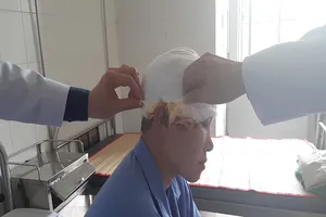 Sửa máy xay lúa, người phụ nữ bị lóc hết da đầu