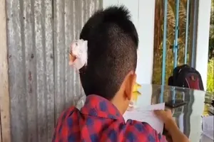 Vĩnh Long: Học sinh lớp 7 bị bạn đánh chảy máu đầu