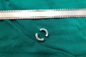 Vào viện cấp cứu vì đeo khoen kim loại cho dương vật