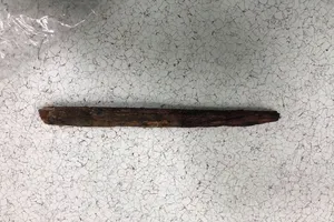 Cụ ông 70 tuổi té xe đạp, bị thanh gỗ đâm thủng phổi