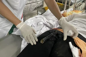 Chân chống xe dính vào mông cô gái sau va chạm giao thông