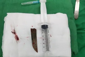 Người đàn ông vào viện cấp cứu cùng mũi dao trên lưng