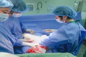 Cần Thơ: Cứu sống 1 phụ nữ thai ngoài tử cung thể hiếm gặp