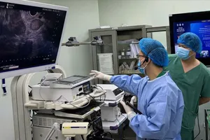 Lần đầu tiên thực hiện nội soi siêu âm tại Đồng bằng Sông Cửu Long