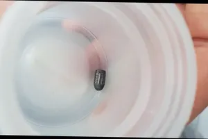 Cần Thơ: Đang làm vườn, 1 phụ nữ bị đạn bắn vào đầu