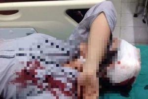 Đã xác định một trong số hung thủ đánh nữ sinh lớp 10