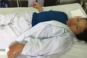 Đi bắt rắn nước bán, bị rắn hổ mang cắn nhập viện