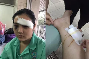 Công an thông tin vụ 'cô gái 16 tuổi bị cắt tai'