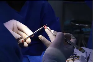 Nâng mũi cấu trúc và những biến chứng nguy hiểm