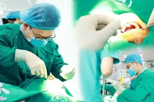 Nha khoa VIET SMILE - Địa chỉ trồng răng tin cậy