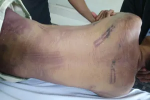 Khởi tố bị can vụ phạm nhân chết trong nhà tạm giữ