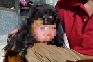 Bà Rịa-Vũng Tàu: HS lớp 6 bị đánh ngất xỉu trong lô cao su ​