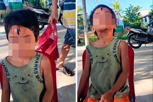 Bé gái 6 tuổi ở Kiên Giang nghi bị cha dượng bạo hành