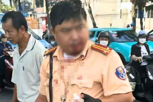 Xử lý va chạm giao thông, 1 chiến sĩ công an bị người đàn ông ngoại quốc tấn công