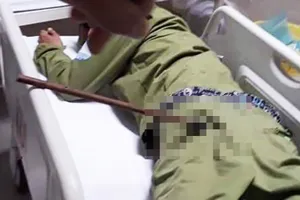 Sửa thông tư để xử lý triệt để nạn cướp chó