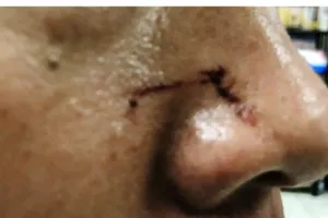 Vụ đánh nhà báo và KSV: Gia hạn tạm giữ 2 người