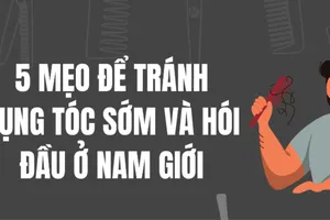 5 mẹo để tránh rụng tóc sớm và hói đầu ở nam giới
