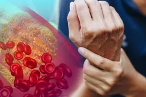 Dấu hiệu cho thấy mức cholesterol xấu đang ngoài tầm kiểm soát