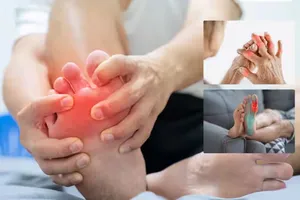 Dấu hiệu cho thấy nồng độ axit uric của bạn đã vượt khỏi tầm kiểm soát