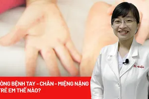 Phòng bệnh tay chân miệng nặng ở trẻ em thế nào? 