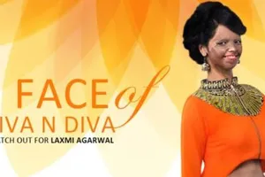 Cô gái bị tạt acid làm người mẫu thời trang