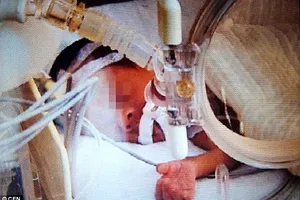 Đứa bé 'chết đi sống lại' sau 15 tiếng trong phòng lạnh âm 12 độ