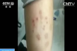 Xây trường trên đất ô nhiễm, gần 500 học sinh phát bệnh