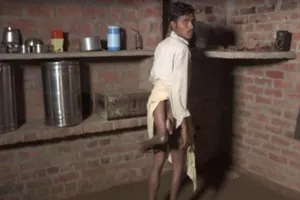 Hi hữu chàng trai Ấn Độ có 4 chân