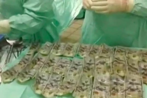 Nuốt chửng 7.000 USD vào bụng vì cãi nhau với chồng