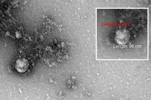 Nga có hình ảnh đầu tiên về biến thể SARS-CoV-2 ở Anh